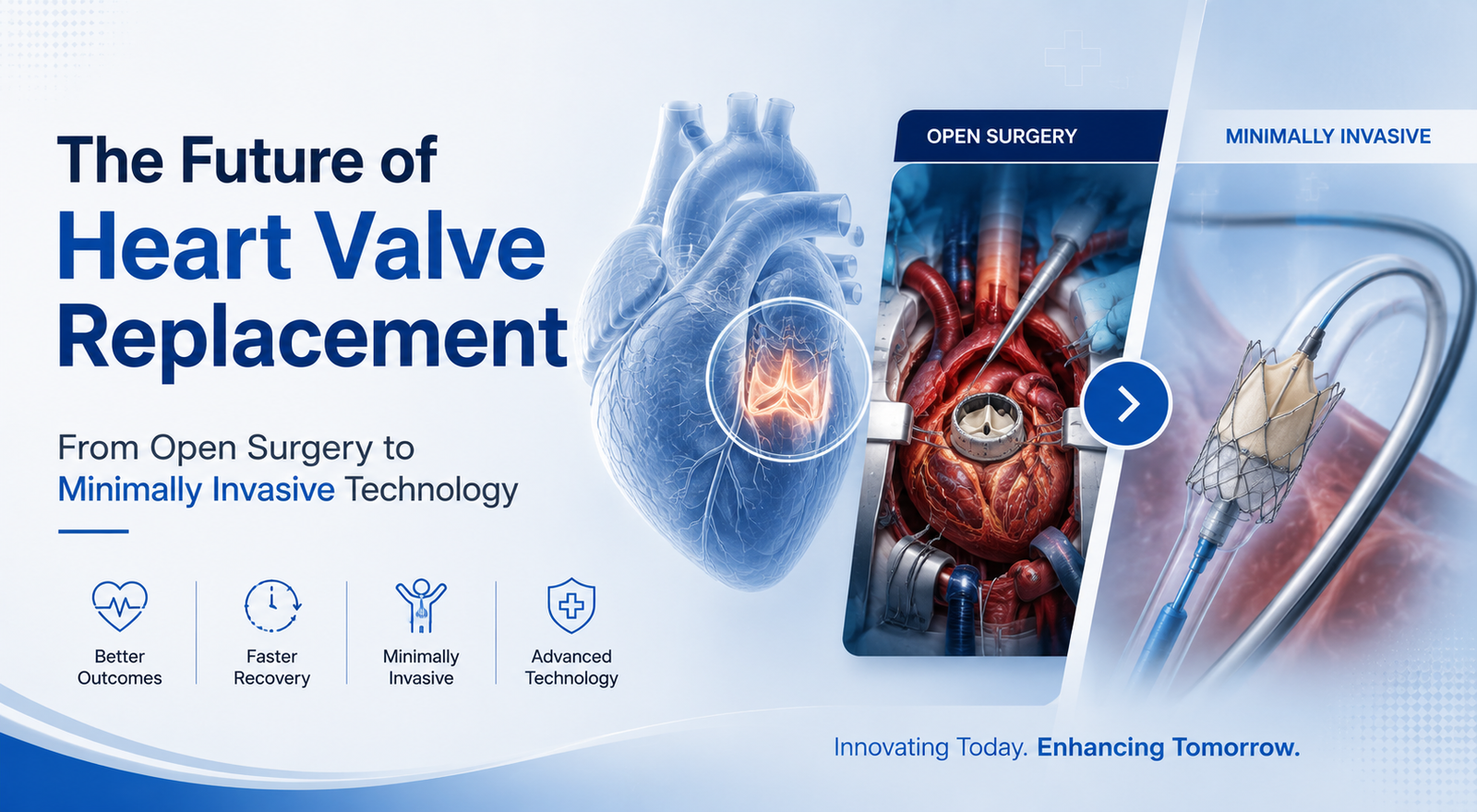 Medical illustration comparing traditional open-heart valve surgery with minimally invasive heart valve replacement technology, featuring a heart, surgical procedure, and catheter-based valve device.